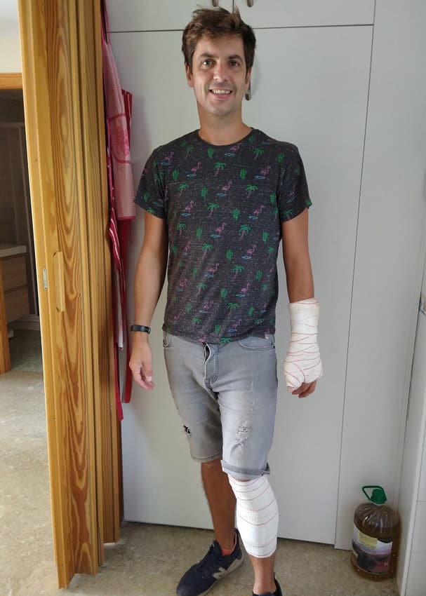 Nunca sabes que puede pasar... Mike despues de un accidente de bici