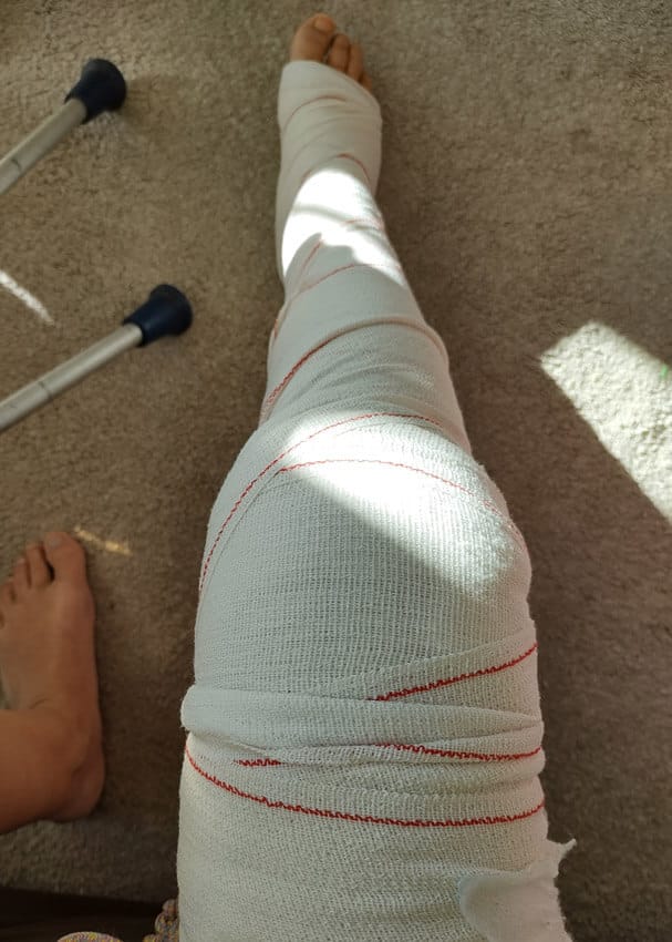 Nunca sabes.... Lucía y su rodilla ya tan famosa