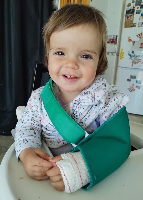 Zoe con su brazo roto.