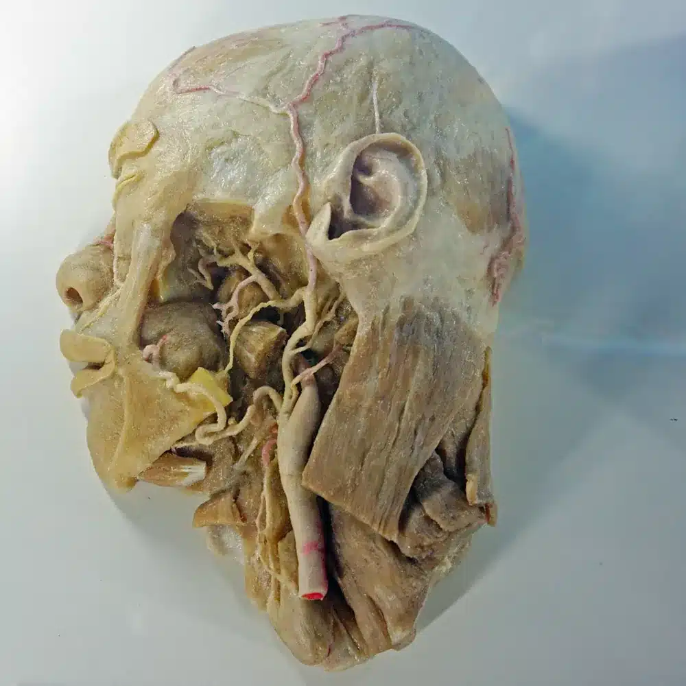 La exposición Bodies Evolution en Málaga: explora el cuerpo humano en familia 3 Cabeza humana plastinada mostrando venas y músculos en detalle en exposición Bodies